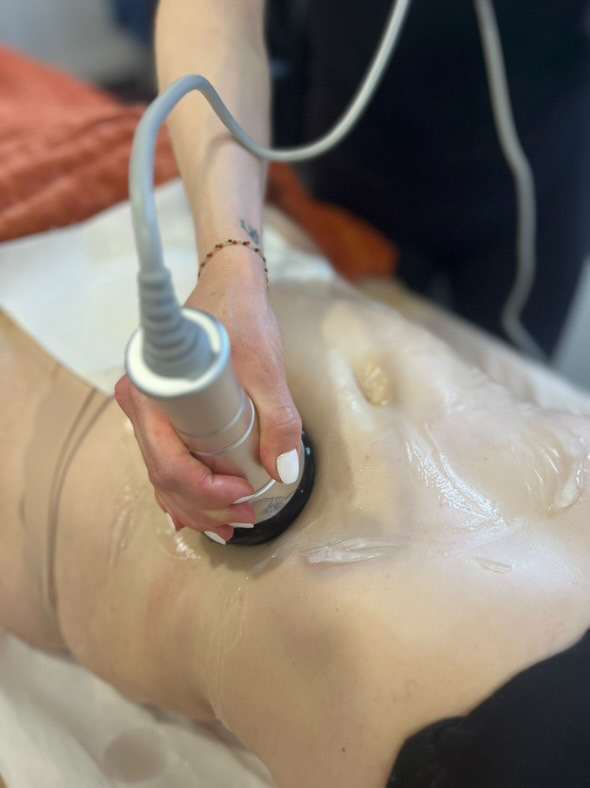 lipocavitation corps